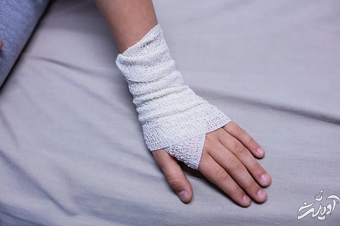 پاک سازی جای زخم با آب اکسیژنه زخم